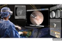 Apple Vision Pro Transforms Operating Rooms for Surgeons